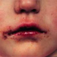 �������� KAWASAKI (4).jpg